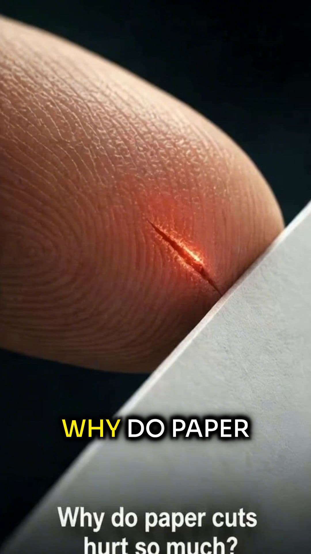 Why Do Paper Cuts Hurt So Much?