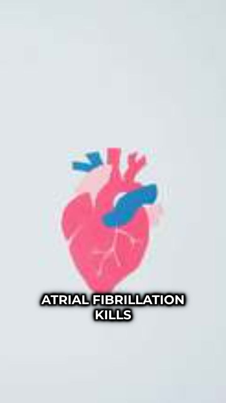 Understanding Atrial Fibrillation