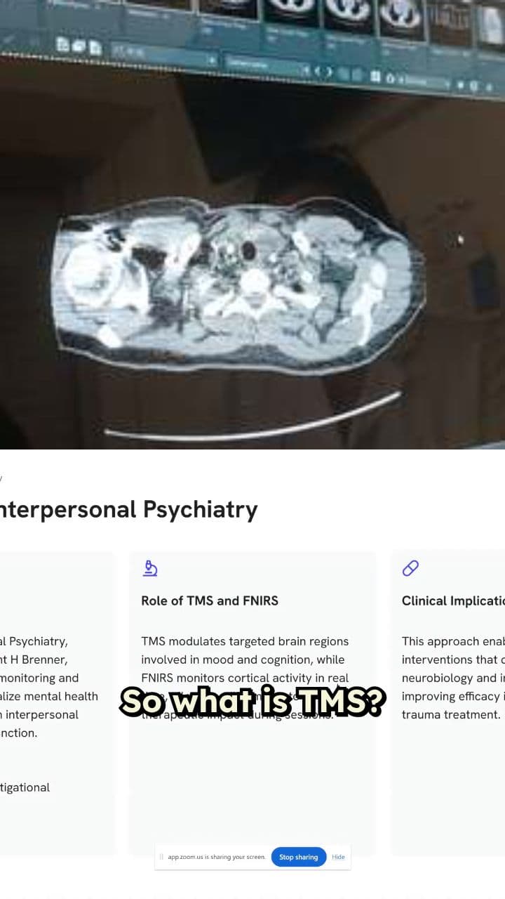 What is TMS? Brain Exercise Explained