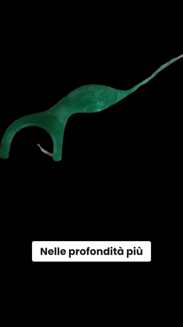 Il Tesoro Flossssss-Spaghetti!