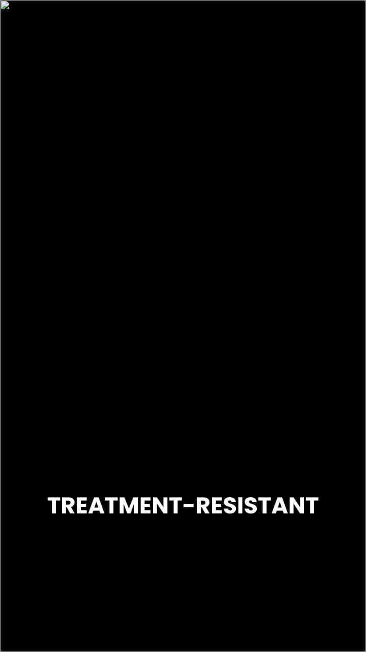 Revolutionizing Treatment for Schizophrenia Resistance
